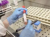 В Украине не зафиксированы случаи инфицирования коронавирусом 