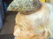 Женщине-единорогу не будут делать операцию