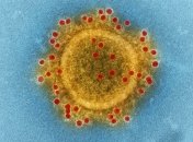 Ще жодне століття не обійшлося без пандемії - експерти