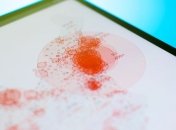  У світі від коронаірусу видужало майже 400 тисяч осіб