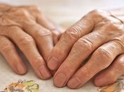 Причины возникновения артрита