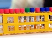 Статистика захворюваності на коронавірус в країнах Балтії