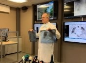 В Днепре от тяжелой формы пневмонии умер мужчина