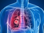 Медики назвали продукты, которые помогут предотвратить рак