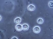 Лейкоциты сообщают об опасности перед смертью