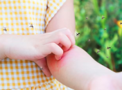 Захистіться від кровосисних комарів