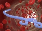 Вирус Эбола мутировал и стал опаснее