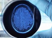 Ученые нашли способ узнать воспоминания после смерти