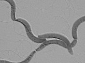 Ученым удалось запечатлеть магнитные поля, создаваемые клетками живых бактерий