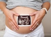 О чем говорят мамы: кесарево сечение