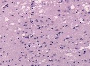 Раскрыт механизм заражения белками-"зомби"