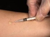 В Украине приостановлены пробы Манту