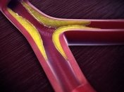 Почему иногда хороший холестерин оказывается плохим