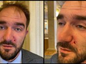 Появилось видео депутатского "махача" в кулуарах Рады