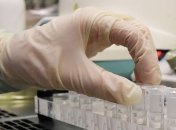 На Хмельниччині лабораторно підтверджено 3 випадки коронавірусу