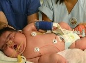 В Германии родился мальчик весом 6,1 кг (Фото) 