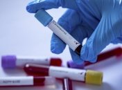 В Минздраве рассказали, чего боятся коронавирусы