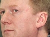 Чубайс: Убийцы Немцова - гнойная опухоль в теле России