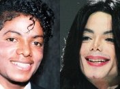 Катастрофические последствия: о неудачной пластике звезд