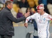 Домагой Вида может принять участие в матче против "Шахтера"