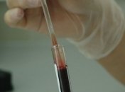 Намного точнее: новый анализ крови может выявить многочисленные типы рака