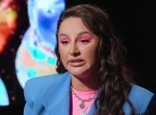 Анна Асти рассказала об операции на ногах