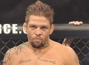 Экс-боец UFC потерял зрение на левом глазу