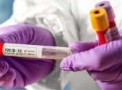 Эпидемия COVID-19: на Сумщине в больницах находятся 69 человек