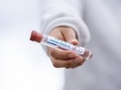 В Украине свыше полтысячи новых случаев COVID-19