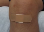 Исследование: на скорость заживления ран влияет генетика