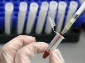 По факту массового заражения гепатитом в Николаеве открыто уголовное дело