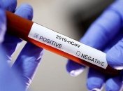 Коронавирус в Украине: за сутки выявили меньше 700 больных