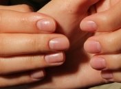 О каких проблемах со здоровьем могут рассказать ногти
