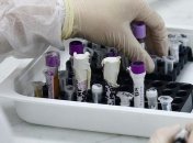 У Бельгії збільшилась кількість випадків коронавірусу