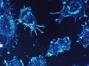 Вчені заявляють, що знайшли можливий спосіб подолання раку