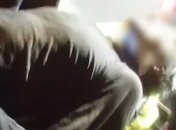 Мужчина чудом выжил после падения из окна на 5 этаже: видео ЧП в Киеве