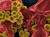 Бактерии модифицируют свои клеточные стенки и побеждают антибиотики: новое исследование