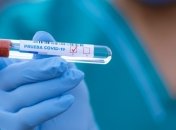 На Житомирщине за сутки зафиксировали 18 случаев коронавируса