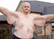 Бывший "самый толстый человек в мире" Пол Мэйсон нашел свою любовь  