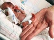 Донецкие медики спасли малышку весом полкилограмма