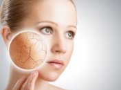 Простые правила: как улучшить цвет лица зимой