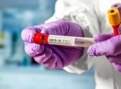 В Україні за минулу добу 339 нових випадків COVID-19