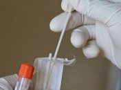 Поражают не только легкие: Степанов указал на особенность новых штаммов коронавируса