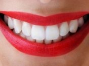 Медики предупредили об опасности отбеливания зубов