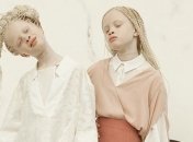 Очаровательные близняшки-альбиносы покорили интернет своей красотой (Фото)