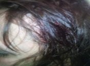 В Харьковской области забросали камнями пассажирский поезд, курсирующий на Донбасс: есть пострадавшие (фото)