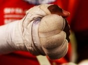 Бой Чисора - Фьюри сорвался: Чисора повредил руку