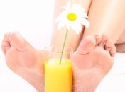 Варикозное расширение вен