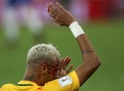 Неймар: Останется лишь небольшой шрам