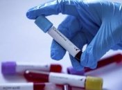 У Львові зареєстровано перший випадок коронавірусу